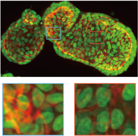 Organoid imaging example. Upper:25 μm pinhole. Lower:50 μm pinhole