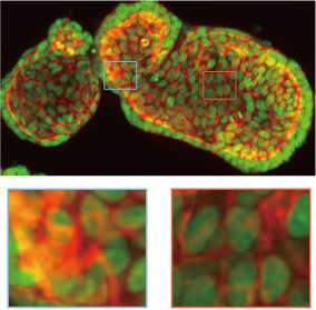 Organoid imaging example. Upper:25 μm pinhole. Lower:50 μm pinhole