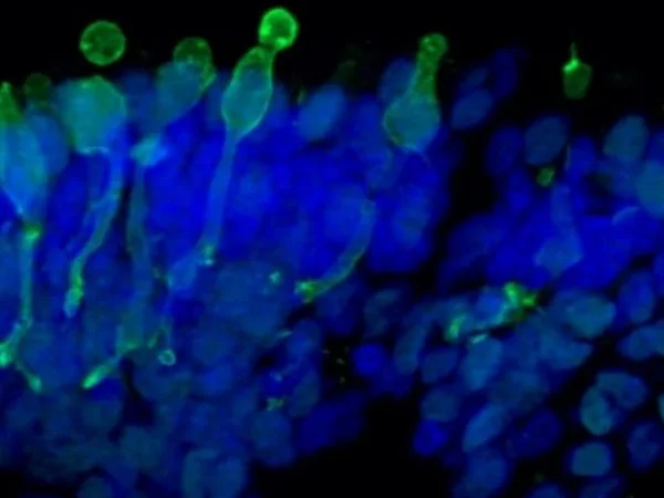 Cone photoreceptor cells labeled with anti-Opsin (Red/Green) antibody