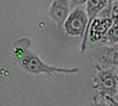Phagocytosis