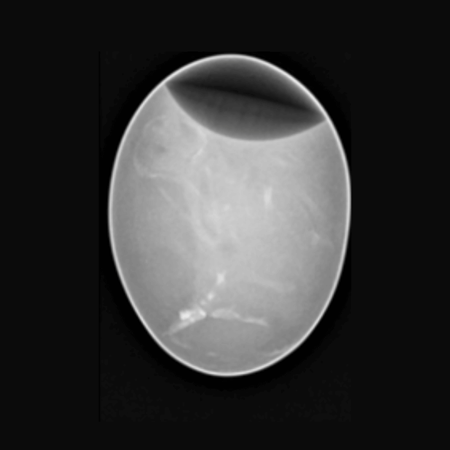 Chicken Egg