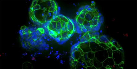 Highly reproducible 3D ready organoids