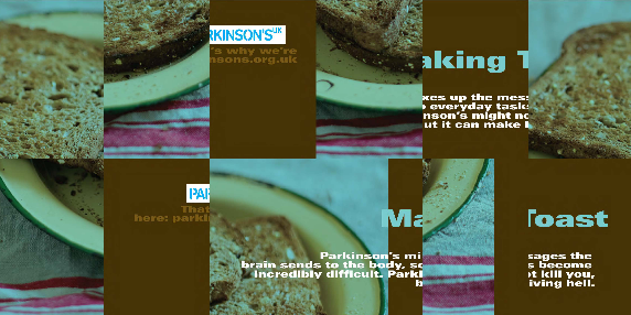 Parkinson