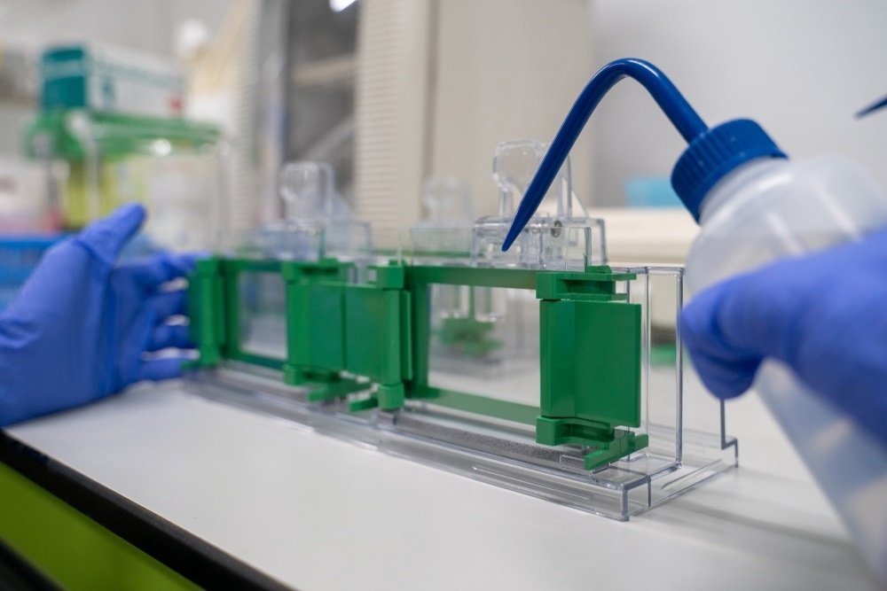 microorganism electrophoresis microorganism electrophoresis