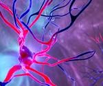 Severe COVID-19 may result in premature aging in recovered patients
