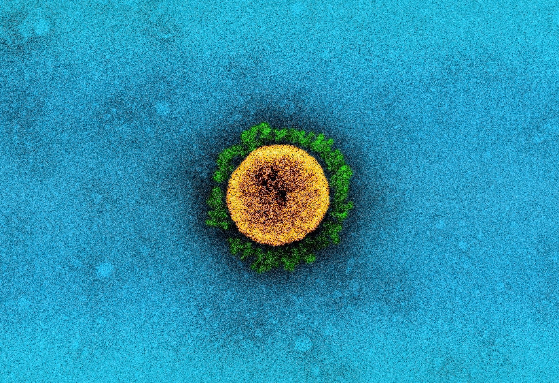 Study: Prediction and validation of host cleavage targets of SARS-CoV-2 3C-like protease. ​​​​​​​Image Credit: NIAID