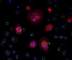Exploring Populations of B and T Cells in Lymph Nodes of Patients Diagnosed with COVID-19 via Microscopy and Image Analysis