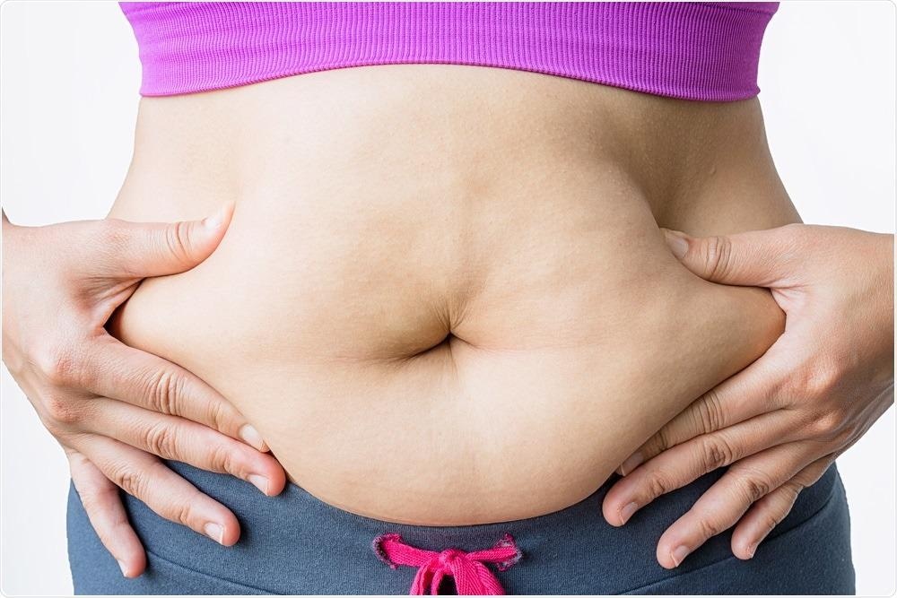 Study: Abdominal Imaging Associates Body Composition with COVID-19 Severity. TaMaNKunG | Shutterstock