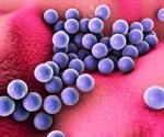 Bacterial coinfection pervasiveness and antibiotic use in COVID-19 patients