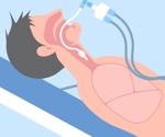 Study suggests single nucleotide polymorphism in interferon receptor impacts COVID-19 outcomes