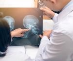 How malaria drugs could play a part in treating chemotherapy-resistant head and neck cancers