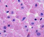 Study generates a picture of the myocardial transcriptional landscape of COVID-19