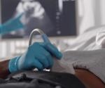 SARS-CoV-2 infection during pregnancy linked to adverse maternal outcomes and preterm birth