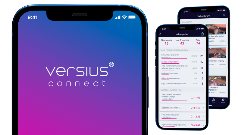 Versius Connect