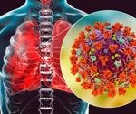 Researchers explore SARS-CoV-2 infection in lung myeloid cells