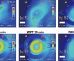 Glaucoma treatment using smart contact lenses that release drugs