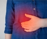Novel oral nano-in-micro system provides efficient curcumin delivery to alleviate ulcerative colitis