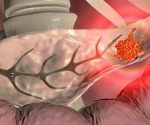 Hitting rewind on the spread of pancreatic cancer
