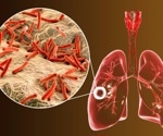 What does the future look like for TB care?