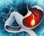 Integrating video capsule endoscopy technology in probiotic research