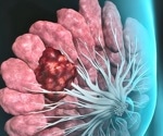 Celebrating 10 Years of Global Research with Breast Cancer Now Tissue Bank