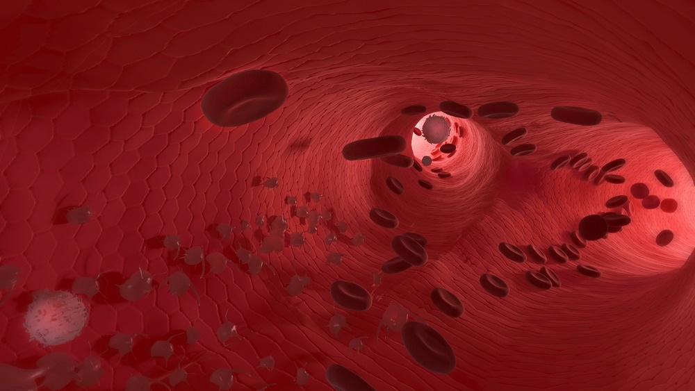 Study: Long COVID endotheliopathy: hypothesized mechanisms and potential therapeutic approaches. Image Credit: AvDe/Shutterstock