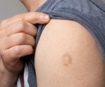 Are antibodies induced by historic smallpox vaccination cross-reactive with the monkeypox virus?