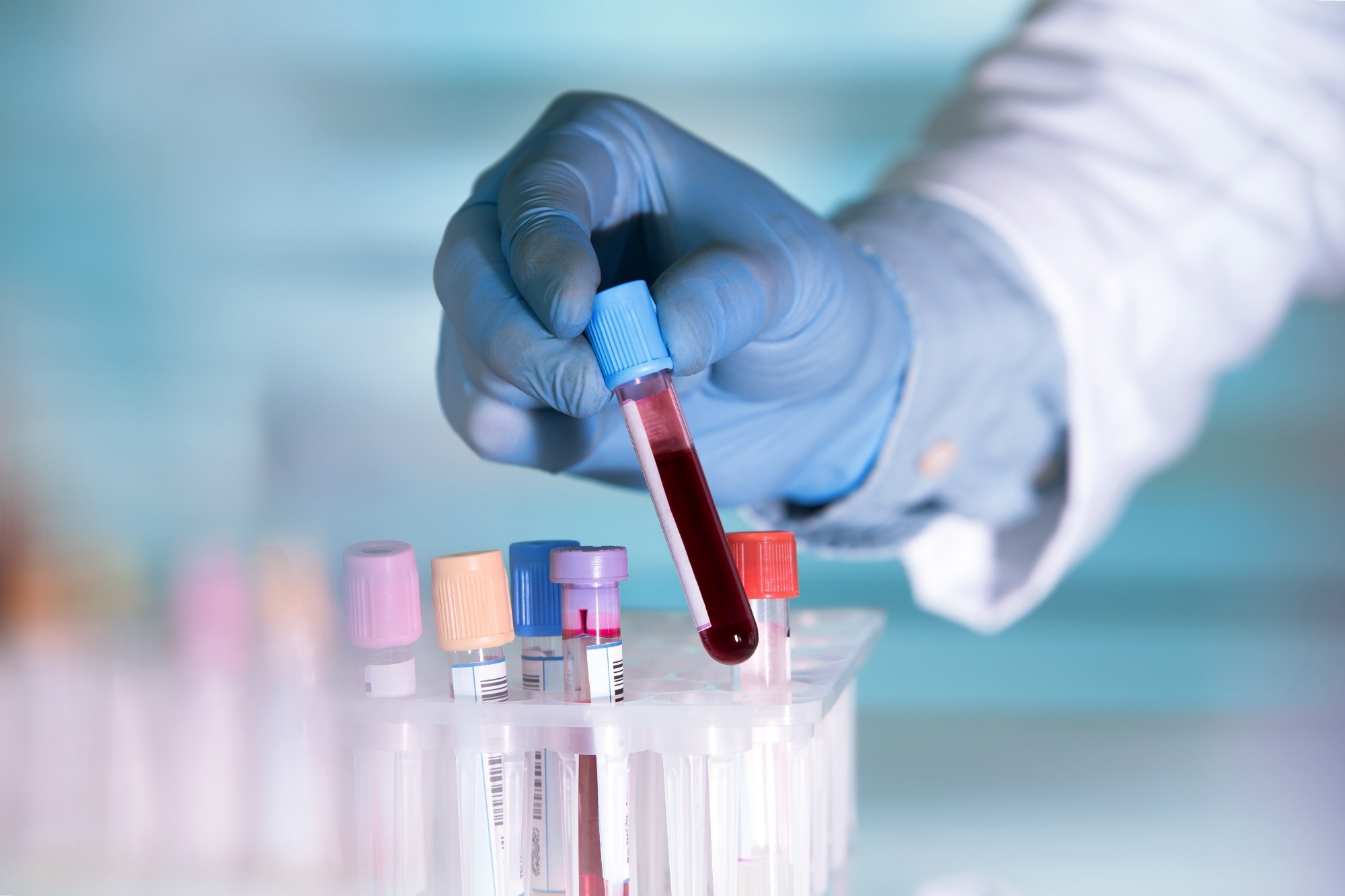 Study: GRAIL Announces Final Results From the PATHFINDER Multi-Cancer Early Detection Screening Study at ESMO Congress 2022. Image Credit: angellodeco/Shutterstock