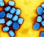 Concern over two cases of monkeypox-related neurological complications in the U.S.