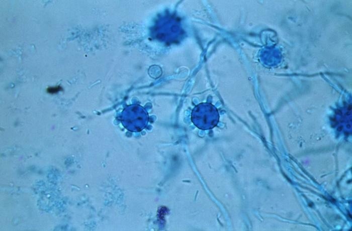 Under a magnification of 800X, this photomicrograph revealed some of the ultrastructural details exhibited by Histoplasma capsulatum fungal organisms, which had been extracted from a Jamaican isolate that included a number of tuberculate, spheroidal macroconidia, and diaphanous filamentous hyphae.