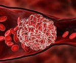 Population-wide cohort study detects increase in major arterial and venous thrombotic events immediately after COVID-19 diagnoses