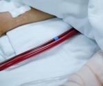 Clinical characteristics and outcomes of patients undergoing extracorporeal membrane oxygenation for COVID-19 acute respiratory distress syndrome