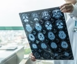 Exploring new therapeutic targets and biomarkers for neurodegenerative disorders