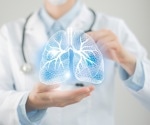 Favorable survival outcomes among COVID-19 lung transplant recipients