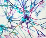 Researchers explore single-cell sequencing technologies to understand molecular mechanisms of autoimmune diseases