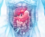COVID-19 and the gut