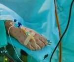 New report on the impact of monkeypox on people with HIV