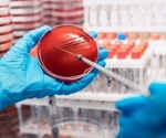 World Antimicrobial Awareness Week 2022: The problem of antimicrobial resistance in combating sepsis