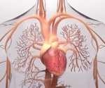 Can monkeypox infection lead to myocarditis?
