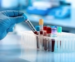 The effects of mechanical forces on musculoskeletal cells and tissues