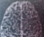 COVID-19 carries a much higher risk of epilepsy and seizures than influenza