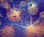 Time-restricted eating may benefit Alzheimer's
