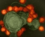 Ultrapotent IgM antibodies isolated from a pregnant woman with Zika virus show promise as an immunotherapy