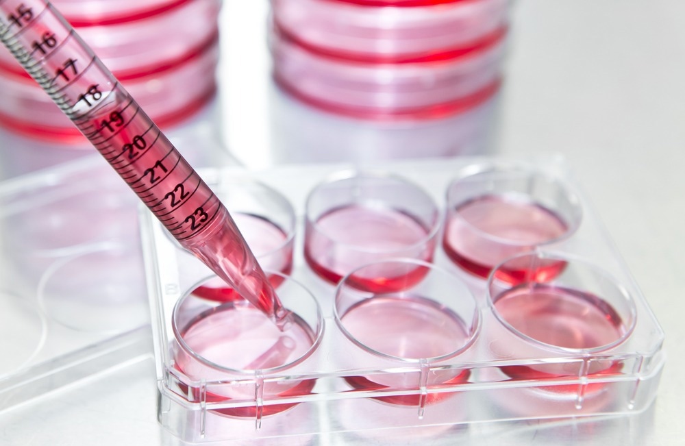 Cell assay