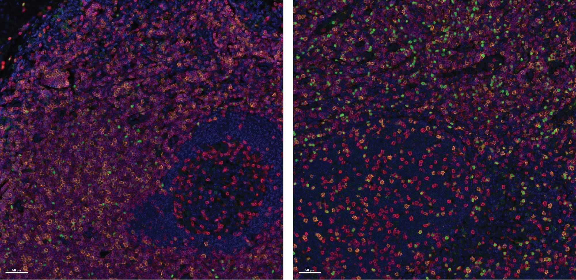 Immunochemistry multiplex for solid tumor analytical validation