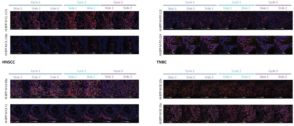 Immunochemistry multiplex for solid tumor analytical validation