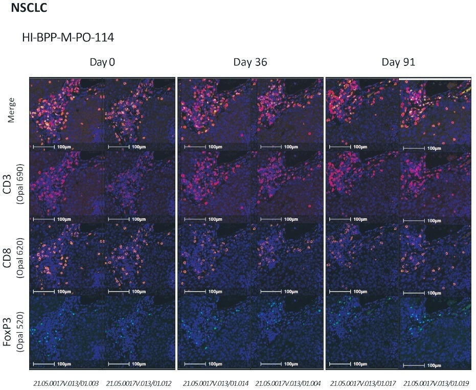 Immunochemistry multiplex for solid tumor analytical validation