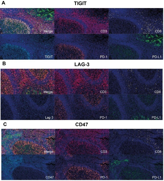 Achieving immune cell checkpoint profiling