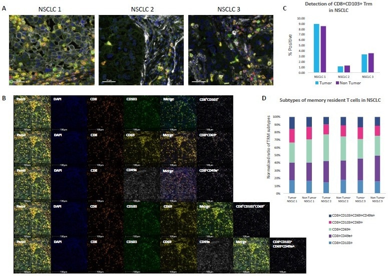 Analyzing regulatory and effector T cells in tumors