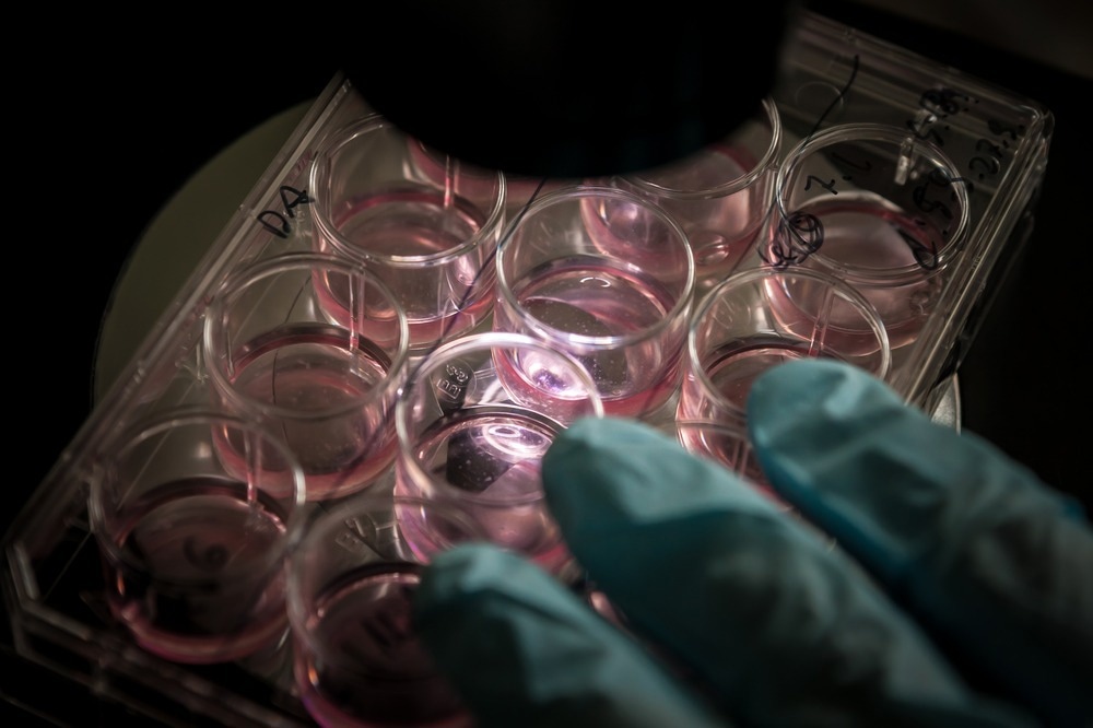 Human Stem Cells